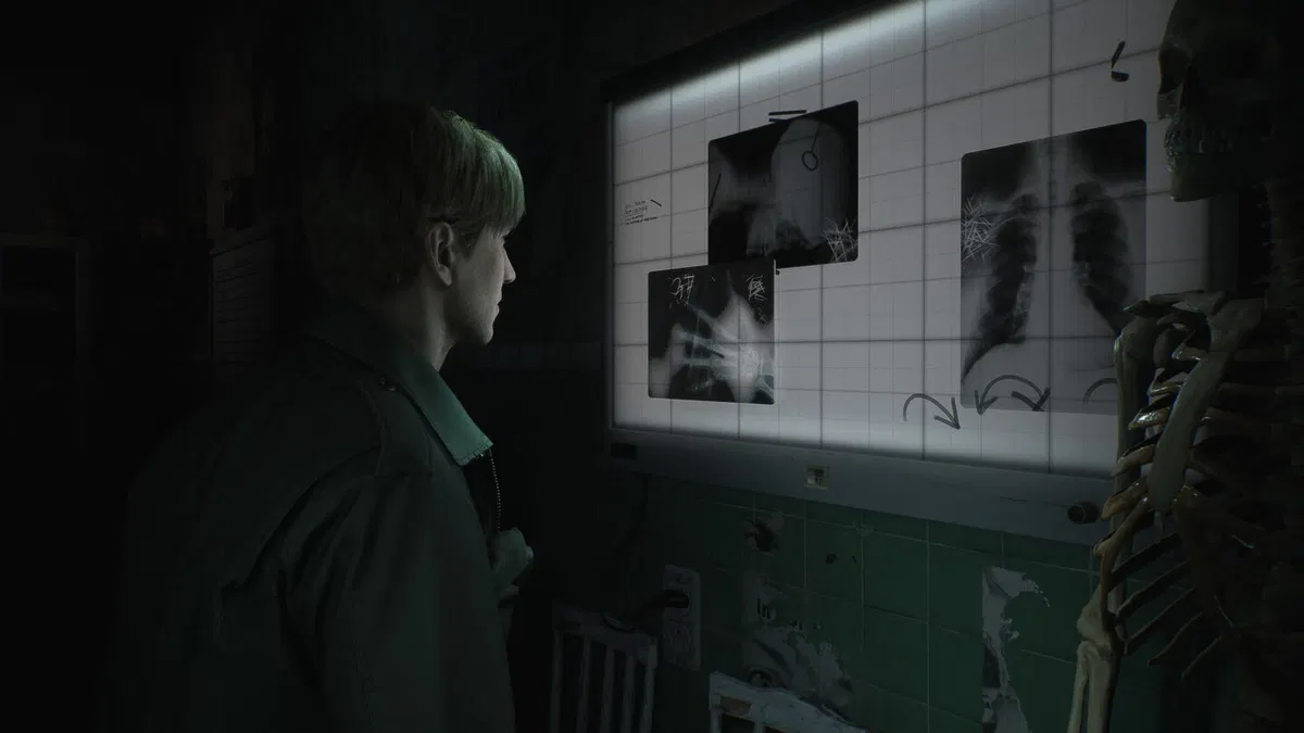 Silent Hill 2 PS5 gameplay – BlueVault Mumbai